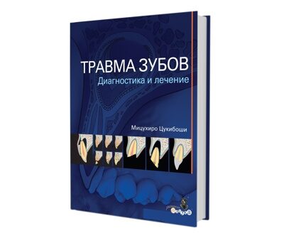 Травма зубов. Диагностика и лечение